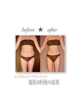 ベルア(Bellelea)/痩身エンダモロジーアライアンス