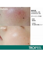 スキンラボアメリ(skin lab. ameri)/お悩み…赤み敏感肌