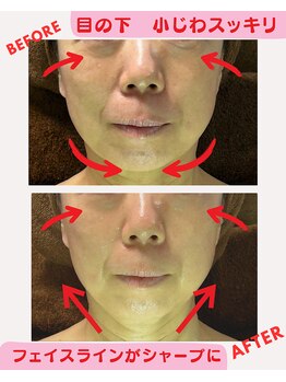 ユーフォリア(Euphoria)/新登場!スピーディリフト