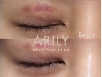 アリリィ(ARILY)/ARILY after care salon