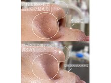 アイラッシュユーリ(Eyelash Juli)の雰囲気（～フェイシャルワックス～WAX顔脱毛 お肌つるつるトーンアップ！）