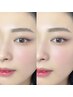 【産毛ゼロ★肌ツヤUP】フルフェイスWAX脱毛+HBL(ハリウッドブロウリフト)