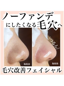 ルネッタ(Lunetta)/