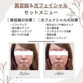 れんげ鍼灸整骨院