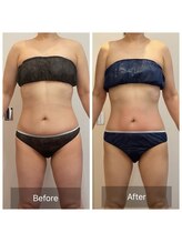 セレア(CELEA)/内臓脂肪/お腹集中/くびれ