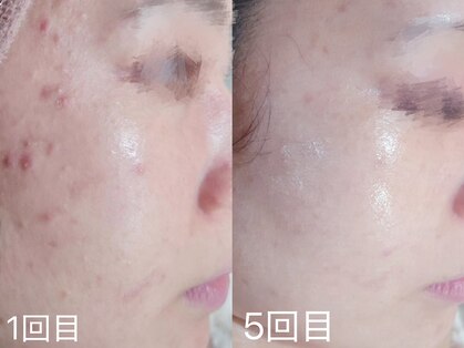 ウィハナ(wehana)の写真