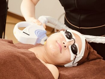 アネラ バイ アンレーブ(ANELA by Un.Reve)の写真/お顔の産毛脱毛でツルツル卵肌へ☆トーンUP&お化粧ノリも抜群に♪【当店人気NO2顔脱毛 ¥3,800】