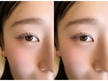 エイト アイ(8 eye)の写真