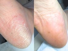 ネイルサロン キリグ(KILIG)