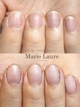 マリーロール 淀屋橋本店(Marie Laure)/自爪育成/深爪矯正/ネイルケア
