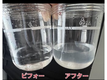 アンジェーム(angeame)/徹底的に毛穴洗浄☆