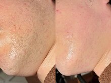 ルーナジェーナ(Luna llena)/池袋　エステ　ルーナジェーナ