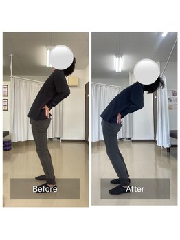 ナオル整体 大里院(NAORU整体)/40代男性 長時間座るのが辛い