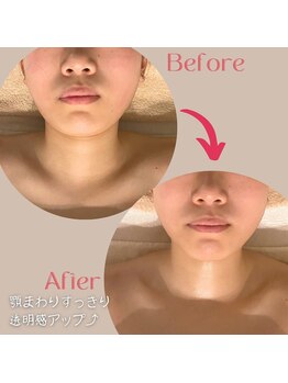 ナナイロ(nanairo)/あご下の浮腫み解消でスッキリ!