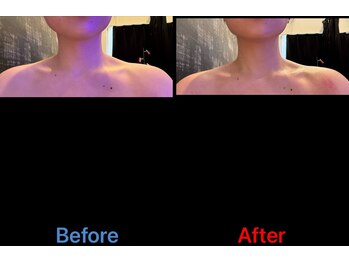 アリアグロウ(Aria Glow.)/スッキリ小顔