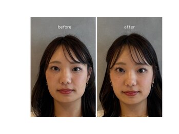 ミトノウ(MITONOU)/お客様ビフォーアフター