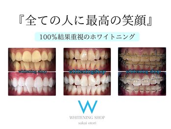 ホワイトニングショップ 鳳店