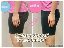 骨盤整体 サクラ(Sakura)/ビフォーアフター/産後骨盤矯正
