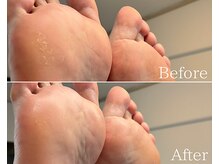 カシェット 広島店(Cachette)/40代女性☆足裏角質ケア90分