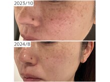 メープルサロン(MAPLE SALON)の雰囲気（くすみやシミにも◎つや肌エイジングコースで集中ケア）