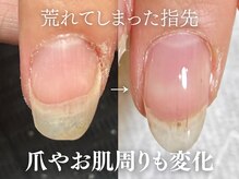 アーク(arc) PG014100055