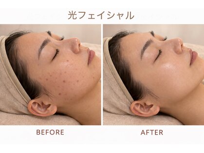 ドール(DOLL)の写真