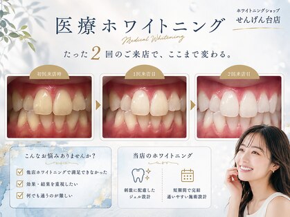 ホワイトニングショップ 越谷せんげん台店の写真