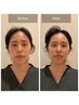 【都度払い】快眠脳ヘッドリンパフェイシャル70分ショートコース