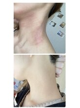 ヴィヴフォー(VIV for)/誰にも言えないお悩みも