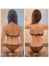 カルナ(carna)/《3か月計6回》2週間に1回