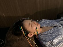 ハリステラ(HariStella)/★リフトアップ【ステラ美容鍼】