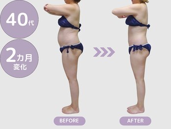 ビップ 赤坂店(Bipp!)/40代・2カ月の変化