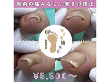 巻き爪補正店 西船橋店