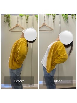 ナオル整体 大里院(NAORU整体)/40代女性 デスクワークが辛い