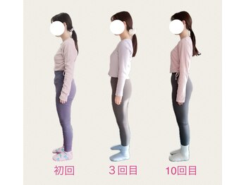 フォーシー(4C)/Before/After