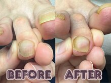 ポドロ ウィズ ニコルル 大阪天満店(PoDoLo with Nicolulu)/【肥厚爪】フットケア大阪・梅田