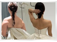 ガーネ 堺店(GARNE)/小顔&痩身ビフォーアフター/20代