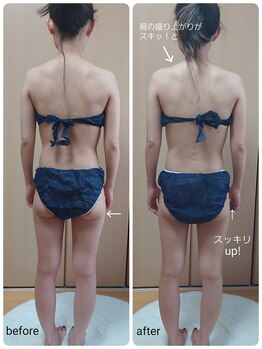 ニワ(Niwa)/温活ボディ施術例