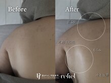 リフィール たまプラーザ店(refiel)/10分でもこんなに違う♪