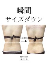 ルミナス/施術効果！