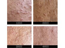 ミミー/4回の変化