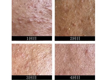 ミミー/4回の変化