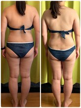 ヨサ パーク コアハート(YOSA PARK CORE HEART)/