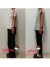 まろん鍼灸接骨院 立川店/姿勢矯正　Before→After！