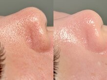 ルーナジェーナ(Luna llena)/池袋　エステ　ルーナジェーナ