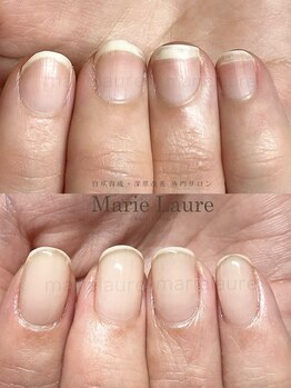 マリーロール 淀屋橋本店(Marie Laure)/自爪育成/深爪矯正/ネイルケア