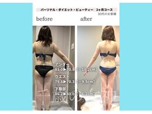 千歳の女神 三河安城店/【施術風景】Before/After