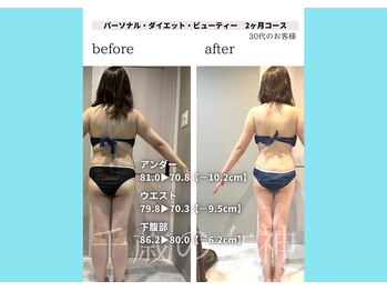 千歳の女神 三河安城店/【施術風景】Before/After