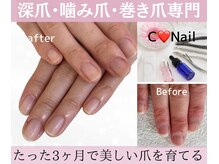 シーネイル(C Nail)