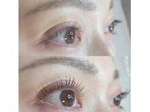大人女性悩みの≪まぶたのたるみ≫≪毛の細さ≫お任せください◎